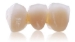 Picture of AxZir ST-Multilayer Dental Zirconia -U10W