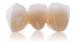 Picture of AxZir TT-Multilayer Dental Zirconia